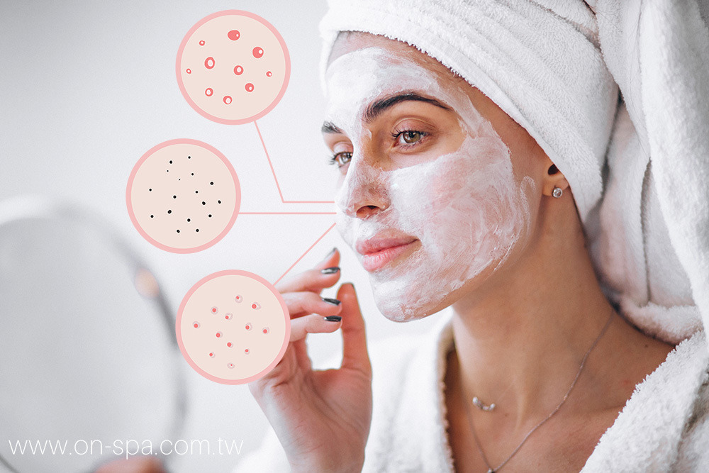 On-Spa 做臉保養 換季過敏 肌膚過敏